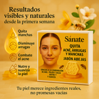 x3 Jabon Miel - Quita Manchas, Anti Arrugas,Acne (Jalea Real) - 40G