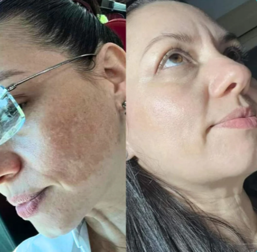 Jabon de Cúrcuma + Acido Kojico Orgánico ¹⁰⁰ᵍ