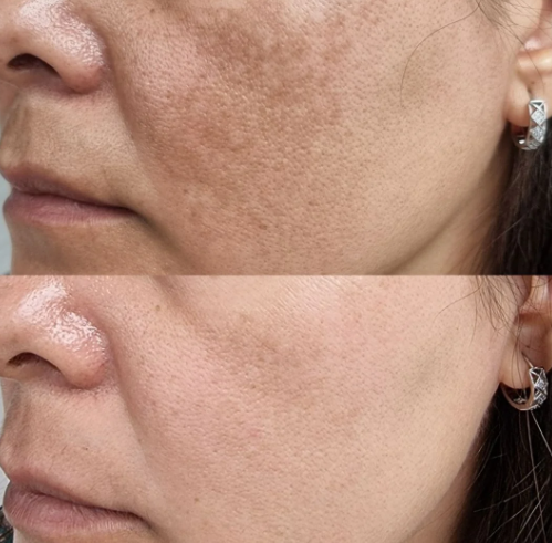 Jabon de Cúrcuma + Acido Kojico Orgánico ¹⁰⁰ᵍ