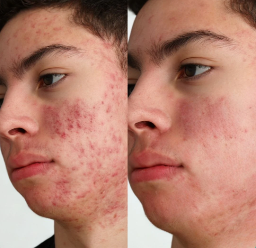 Jabon de Cúrcuma + Acido Kojico Orgánico ¹⁰⁰ᵍ